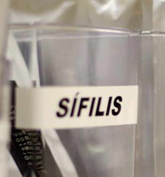 Ministério da Saúde Lança Campanha Nacional de Enfrentamento à Sífilis