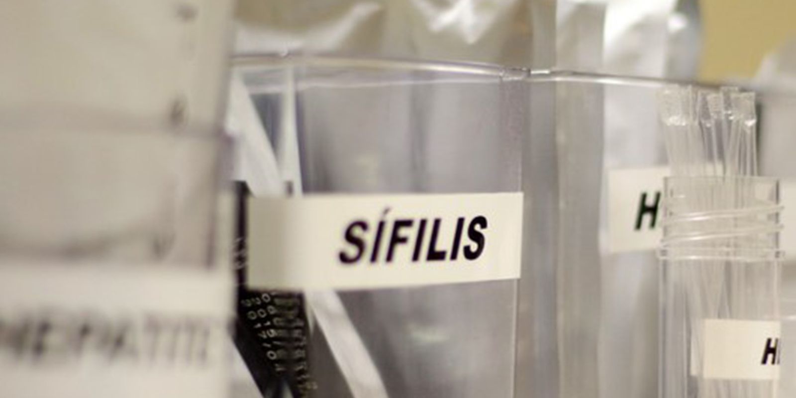 Ministério da Saúde Lança Campanha Nacional de Enfrentamento à Sífilis