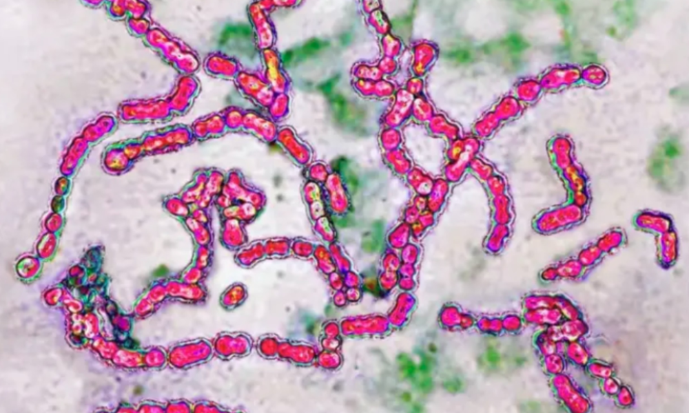 A Bactéria Estreptococo: Riscos e Sintomas