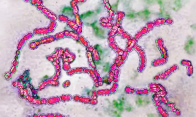 A Bactéria Estreptococo: Riscos e Sintomas