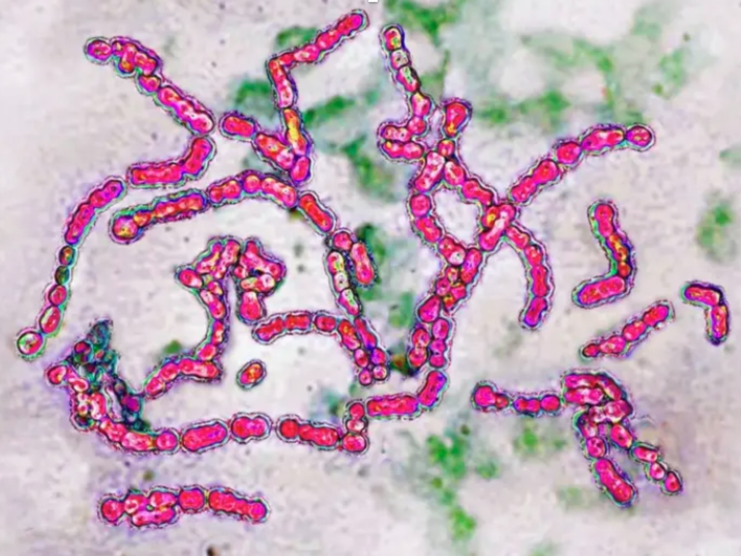 A Bactéria Estreptococo: Riscos e Sintomas