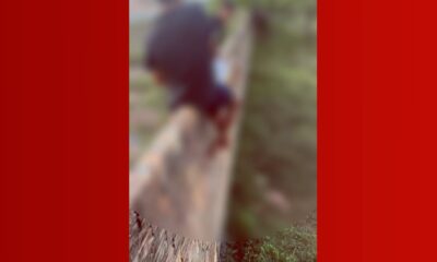 Criança é Ataque por Porco Selvagem em Governador Nunes Freire, Maranhão